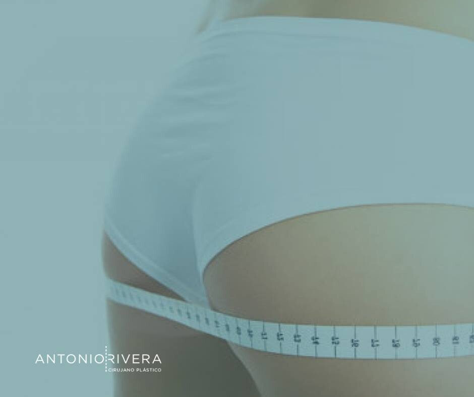 Before and After Result